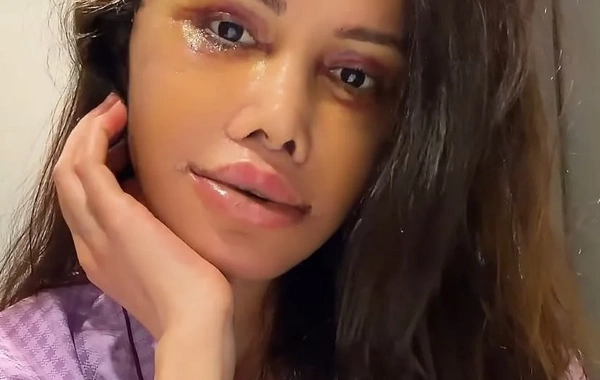 Keçmiş "Survivor" iştirakçısı üz nəqli əməliyyatı keçirdi