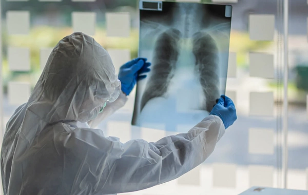 Azərbaycanda bu xəstəliklə mübarizə üçün VACİB ADDIM