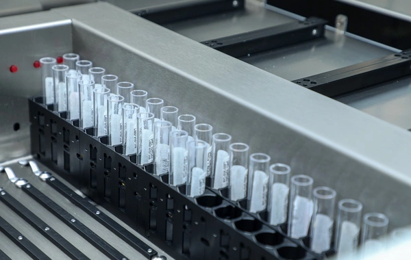 Mərkəzi Neftçilər Xəstəxanasında yeni autoimmun laboratoriyası istifadəyə verilib