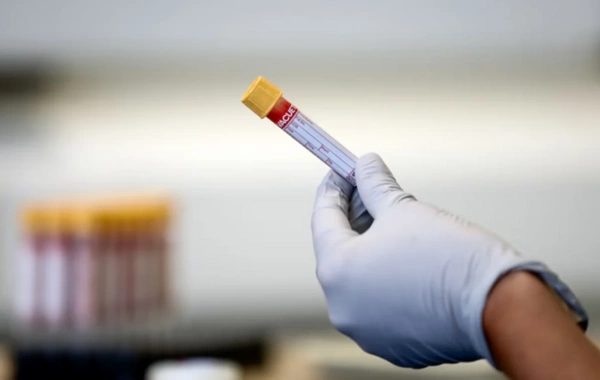 Nikahdan əvvəl narkotest tələbi və reallıqlar: Mütəxəssislər nə düşünürlər?