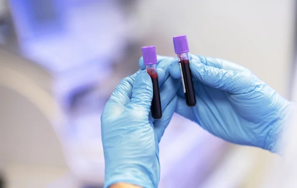 Развеян популярный миф об общем анализе крови