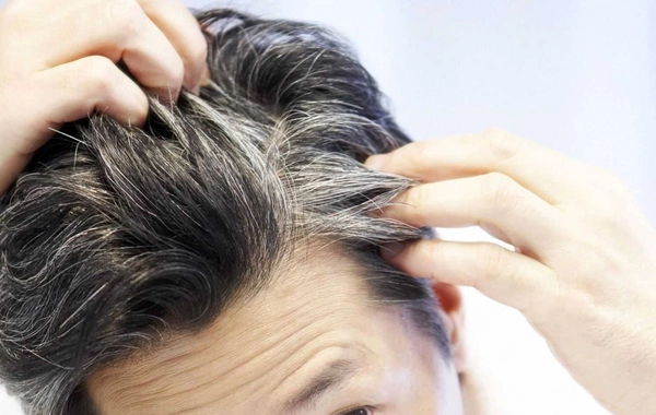 Можно ли избавиться от седины?