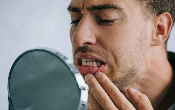 Названа неочевидная причина появления микротрещин в зубах