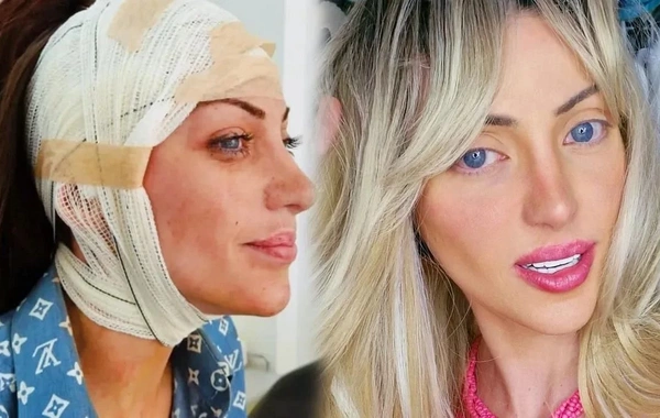 Canlı Barbie kimi tanınan influser müəmmalı şəkildə ölü tapılıb