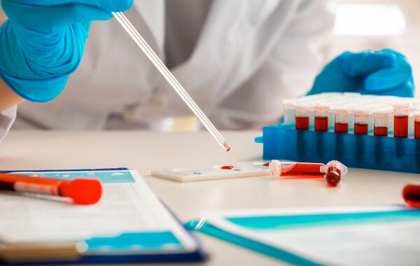 A factor that accelerates aging in middle-aged men has been identified