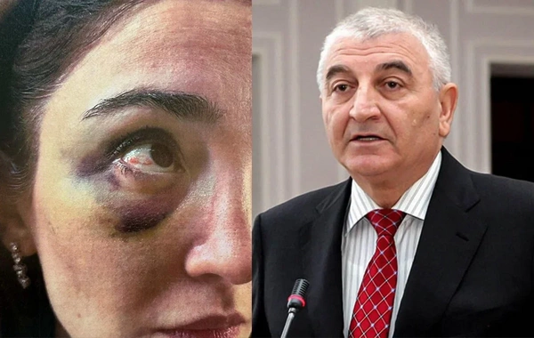 Keçmiş gəlinindən Məzahir Pənahova İTTİHAM: Ona nüfuz önəmli deyil, zinət əşyalarımı qaytarmırlar