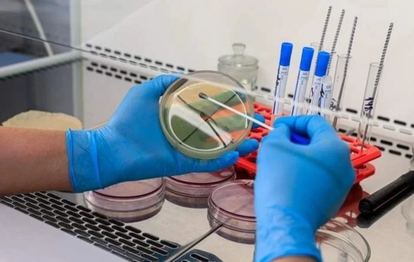 Bir sıra Avropa ölkəsi hantavirus riskinə qarşı hazırlıq görür