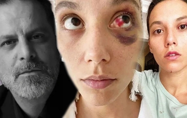 45 yaşlı aktyor sevgilisini döydüyünə görə 45 gün həbsxanada qalacaq