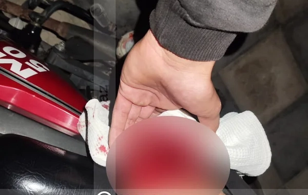 Bakıda VAZ-2107 11 yaşlı uşağı vurub qaçdı, polis yaxaladı