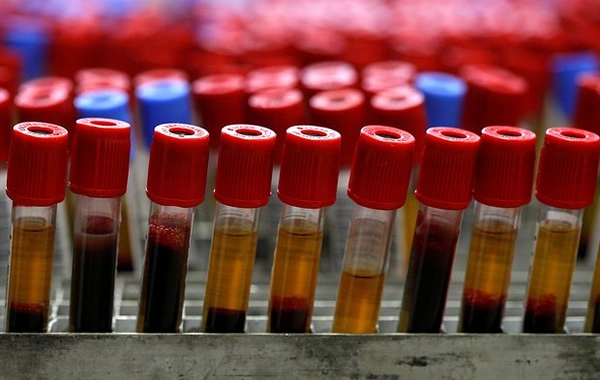 Найден способ точно предсказать риск ранней смерти