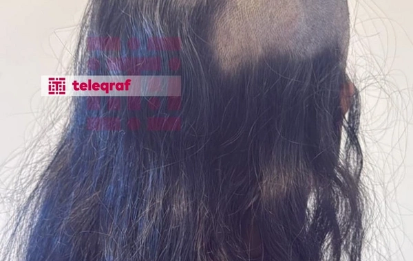 Canlı yayımda saçı qırxılan qadın: "Ərim məni şantaj etməyə başladı"