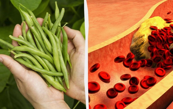 Диетолог назвала лучший углевод, который снизит уровень холестерина в крови