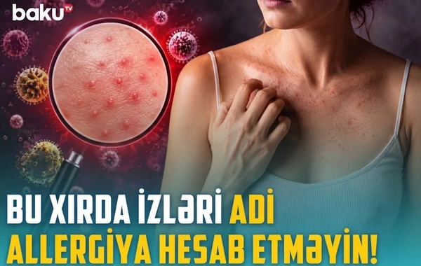 Qısa təmasla yoluxma riski: Ev heyvanınız infeksiya mənbəyinə çevrilə bilər