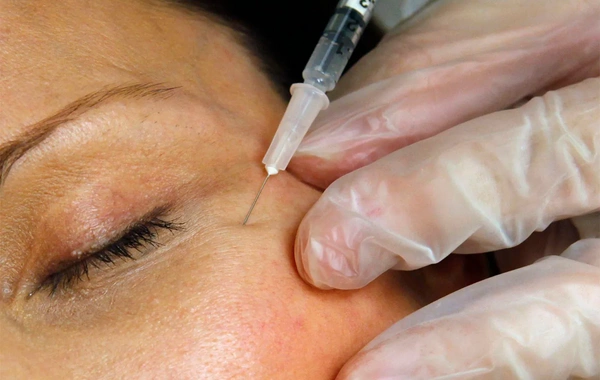 Botox və dolğu etdirənlərə RƏSMİ XƏBƏRDARLIQ