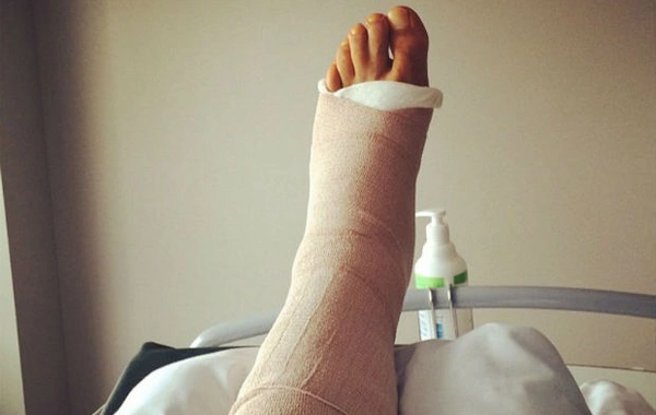 TƏBİB Sabunçu Tibb Mərkəzində pasiyentin öz hesabına gips alması iddialarına aydınlıq gətirdi