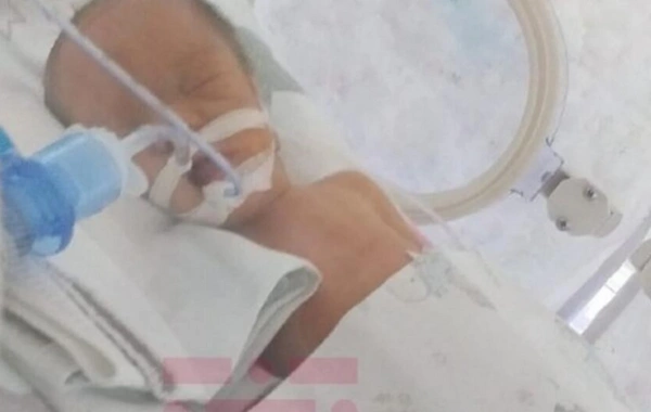 В Баку двое из тройняшек погибли после рождения, родители обвиняют врачей