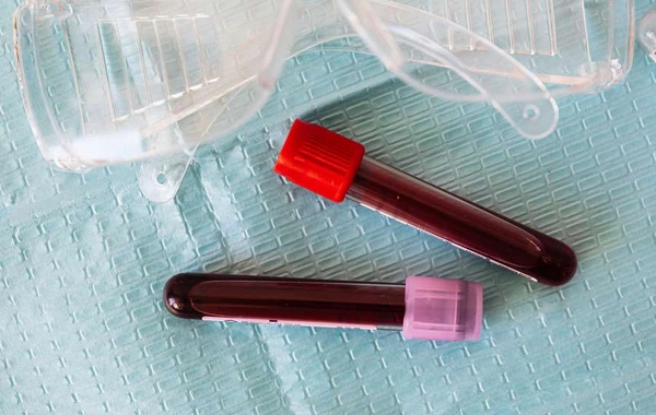 Blood test that helps "predict" heart attack