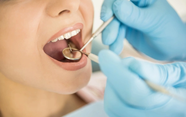 Как кариес связан с диабетом, инсультом и бесплодием