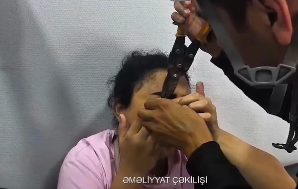 FHN: Göz qapağı geyiminin zəncirbəndinə ilişən qadına köməklik göstərilib