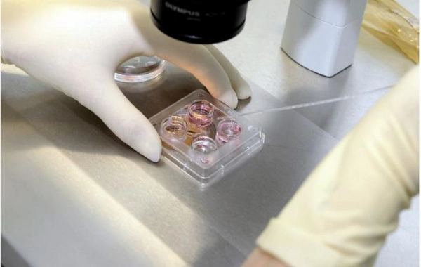 Qanunsuz süni mayalanma və tibbi sterilizasiyaya görə cəzalar sərtləşdirilir