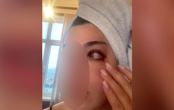 Keçmiş sevgilisindən tanınmış fitnesçiyə ittihamlar: "550 min manat pulumu ələ keçirib, məni dəfələrlə döyüb"
