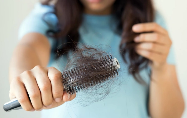 Врач назвала неочевидные причины выпадения волос