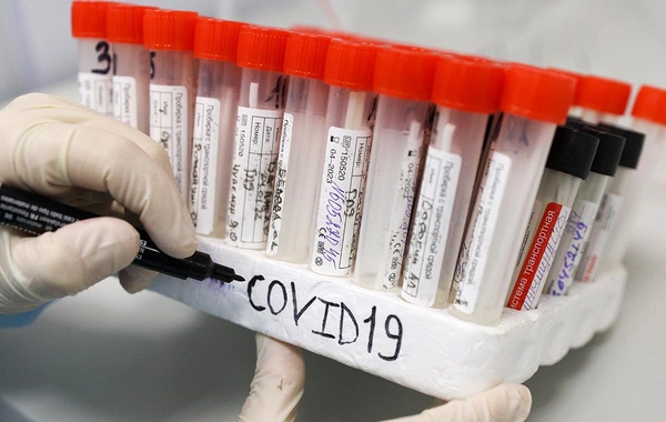 Named the signature symptom of the new coronavirus strain