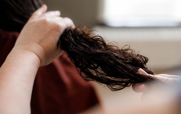 6 Most Common Causes of Hair Loss Named