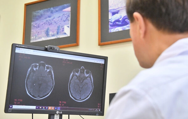 A hidden cause of rare childhood stroke has been identified