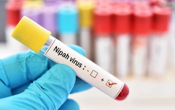 Врачи объяснили, как распознать смертельно опасный вирус Нипах вовремя