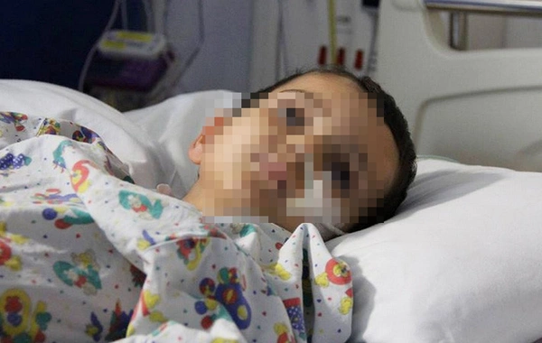 Bakıda 2 yaşlı uşaq qəfil öldü