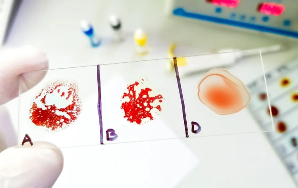 Hansı qan qrupu sağlamlıq baxımından daha üstün sayılır? – Araşdırma