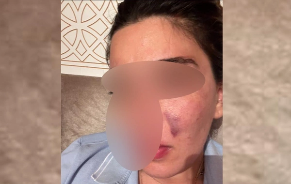 Keçmiş sevgilisindən tanınmış fitnesçiyə ittihamlar: "550 min manat pulumu ələ keçirib, məni dəfələrlə döyüb"