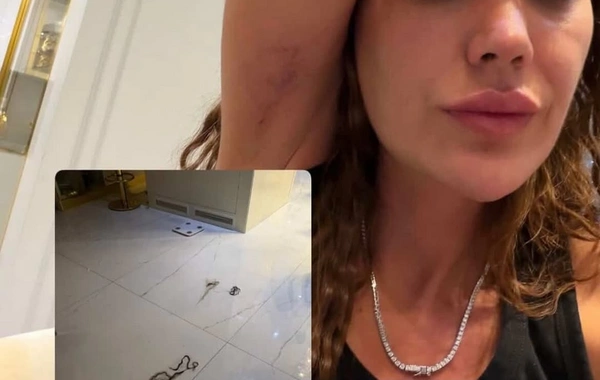 Bacısı Dilan Polatı döydü