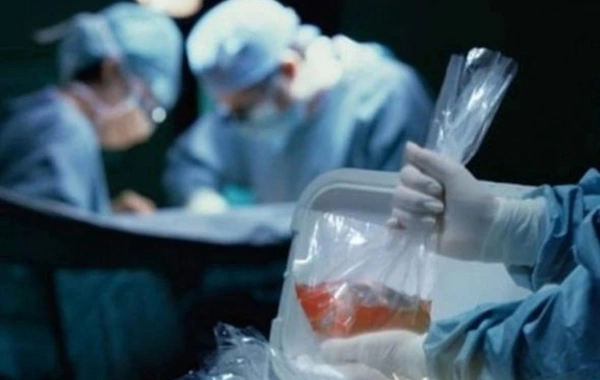 1000-dən çox insan orqan nəqli üçün növbədədir - RƏSMİ