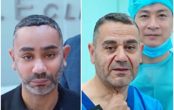 58 yaşlı kişi gəncləşmək üçün Viyetnama getdi, tanınmaz hala düşdü