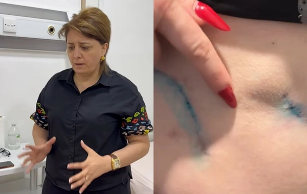 Prokurorluqda pasiyentin ölüm işində adı keçən həkim yenidən cərrahlıq edir?