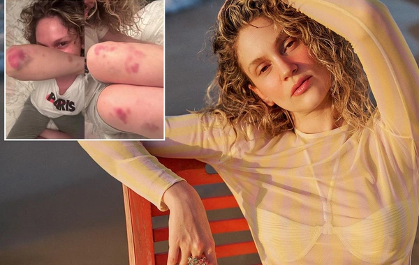 Farah Zeynep Abdullahın bu görüntüləri sevənlərini qorxutdu