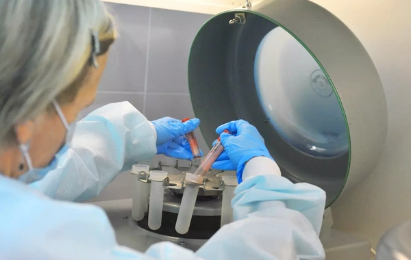 Moskvanın bir rayonunda quduzluq yayıldı - Karantinə aldılar