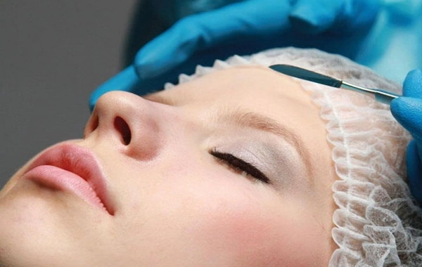 Burun əməliyyatı psixi pozuntu yaradır? - Həkimdən açıqlama