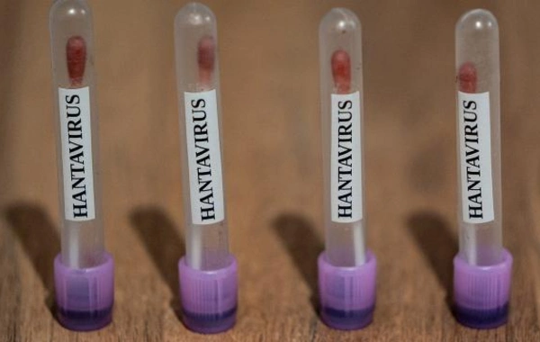 ABŞ hantavirus hallarını 3-cü səviyyə fövqəladə vəziyyət kimi izləməyə başladı