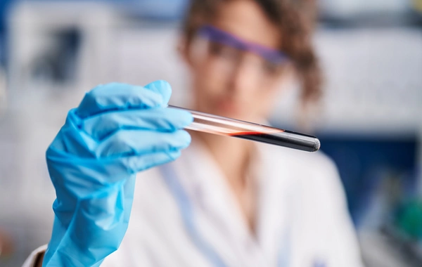 Создан препарат для омоложения клеток крови