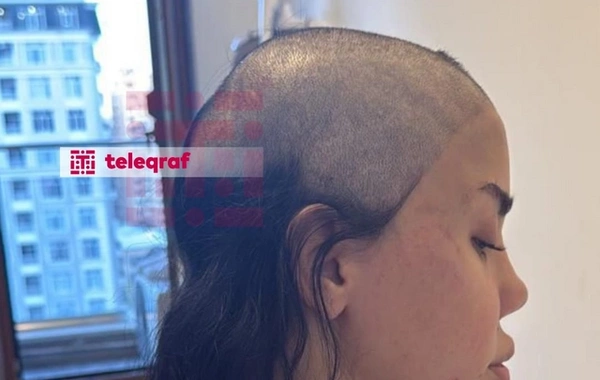 Canlı yayımda saçı qırxılan qadın: "Ərim məni şantaj etməyə başladı"