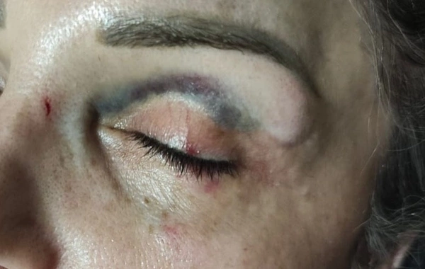 Bakıda mağazaya girib qadını yumruqlayan kişi HƏBS OLUNUB