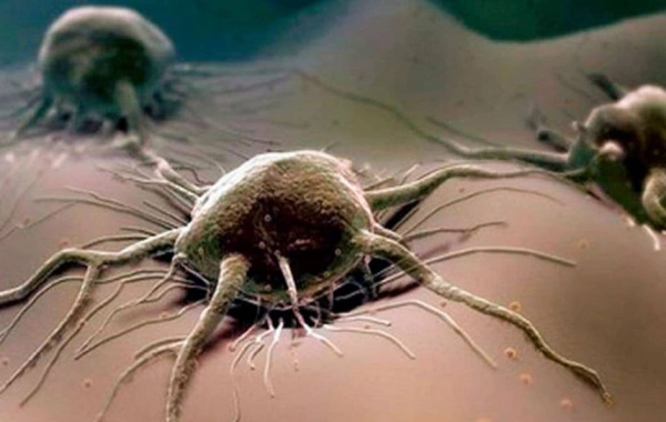 Cancer mortality has sharply increased due to an unexpected factor