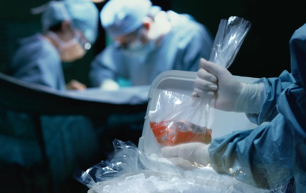 1000-dən çox insan orqan nəqli üçün növbədədir - RƏSMİ