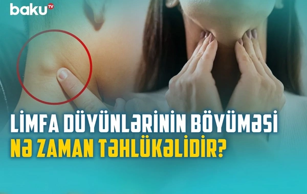 Xoşxassəli və bədxassəli limfa düyünlərinin əsas fərqləri: Həkim məsləhəti