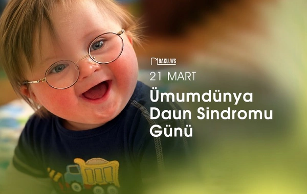 Bu gün Ümumdünya Daun Sindromu Günüdür