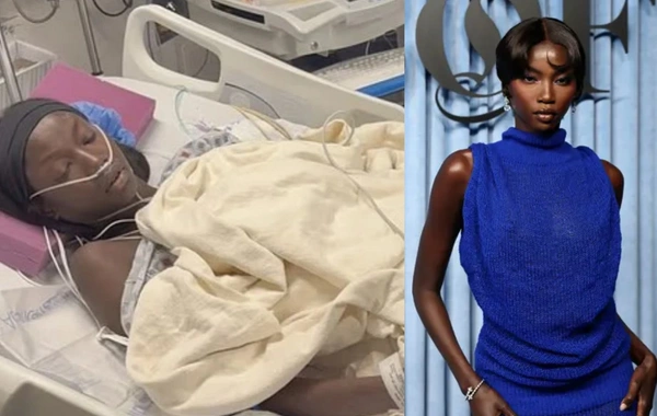 28 yaşlı modelin xəstəxanadan görüntüləri yayıldı