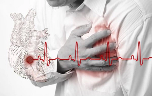 Alimlər infarkt və insultun qarşısını almağın yeni yolunu KƏŞF ETDİ - Bu dərmanla…